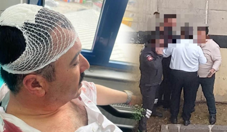 Belediye Başkan Yardımcısına Makamında Saldırı: YRP Üyesi Yönetici Tutuklandı